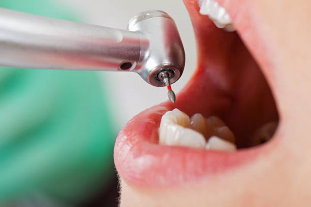 Best Emergency Dentist for Knocked-Out Tooth in Lockhart, TX